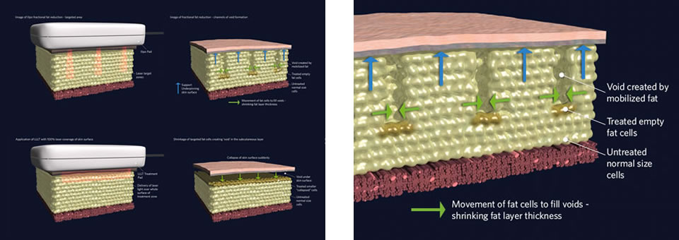 medical illustration